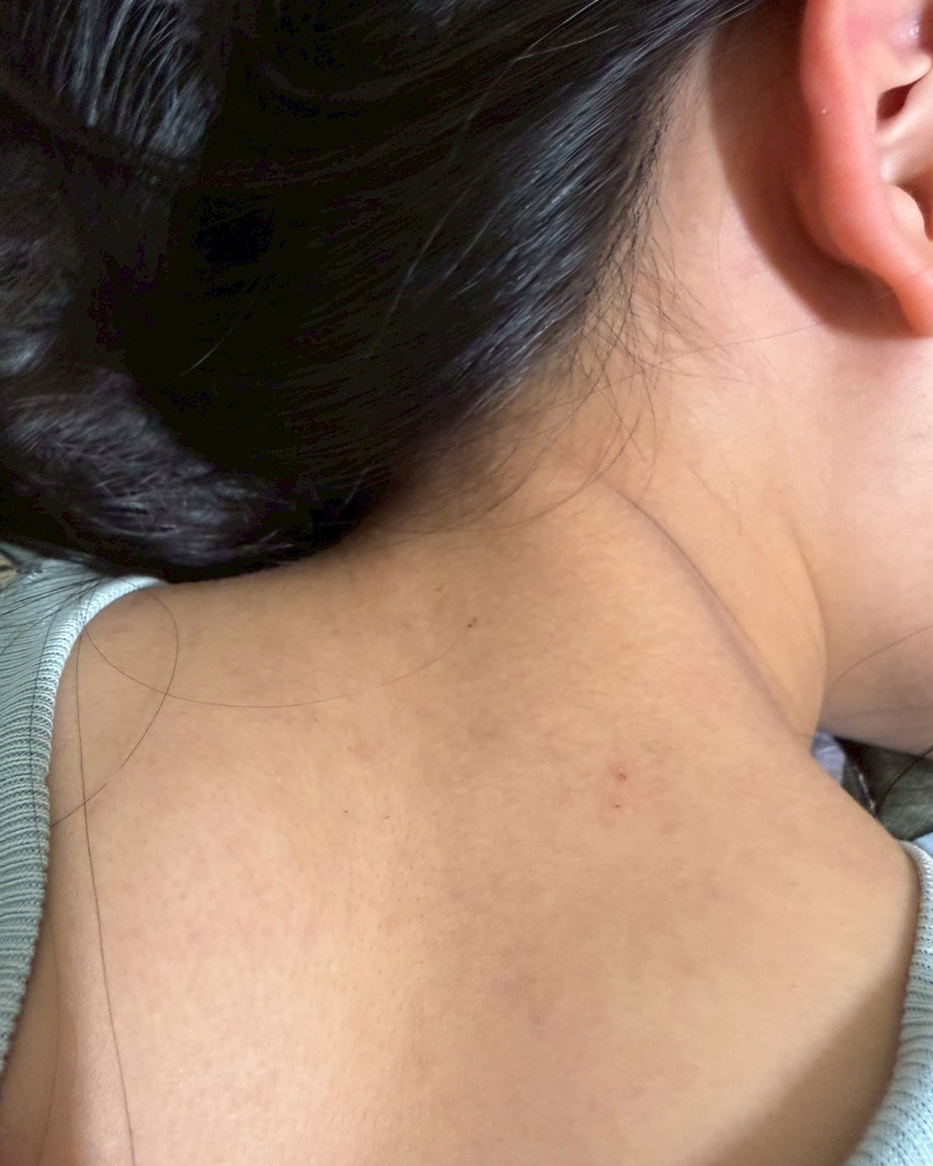 異位性皮膚 沐浴乳